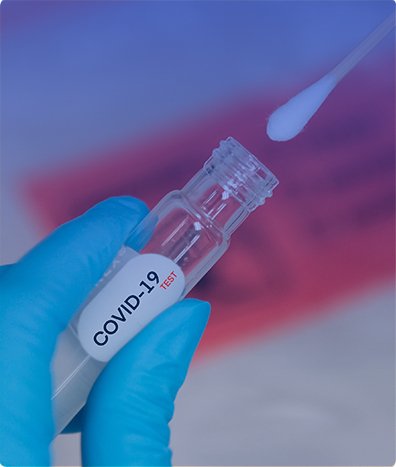 PRUEBA COVID-19 POR PCR (VARIANTES)